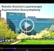 Robotic assisted laparoscopic augmentation ileocystoplasty