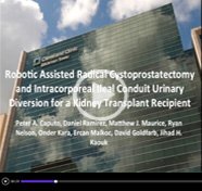 Robotic Assisted Radical Cystoprostatectomy and Intracorporeal Ileal Conduit Urinary Diversion for a Kidney Transplant Recipient