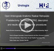 Open anterograde anatomic radical retropubic prostatectomy technique: description of the first fifty-five procedures