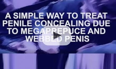 A simple way to treat penile concealing due to webbed penis