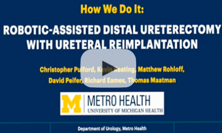 How we do it: robotic-assisted distal ureterectomy with ureteral reimplantation
