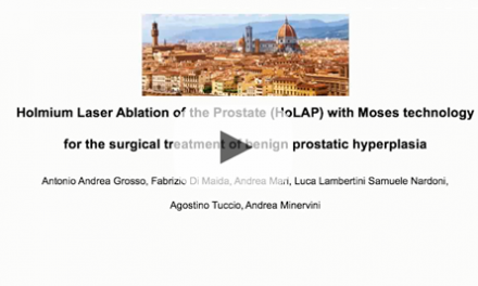 Holmium laser ablation of the prostate (HoLAP) with moses technology for the surgical treatment of benign prostatic hyperplasia